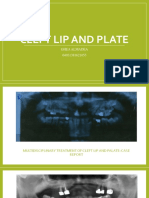Cleft Lip and Plate
