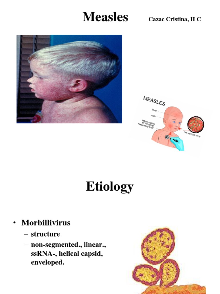 Measles Virus: Transmission and Symptoms | PDF | Measles | Immune System