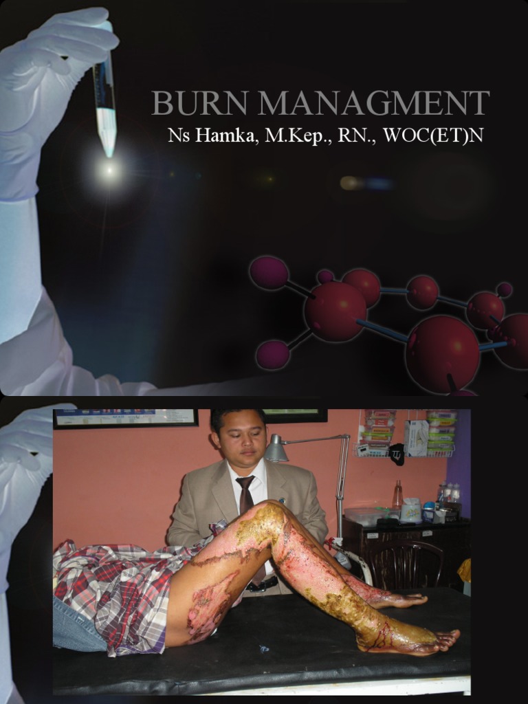 Luka Bakar PDF Wound Clinical Medicine