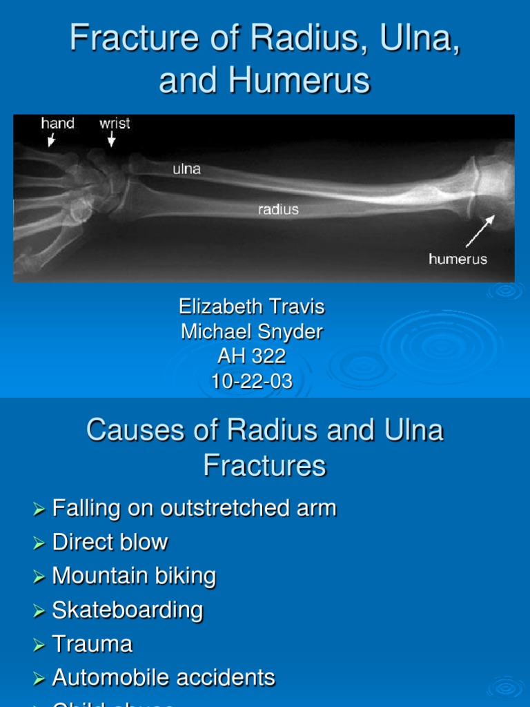 Fracture of Radius, Ulna, and Humerus | PDF | Injury | Musculoskeletal ...
