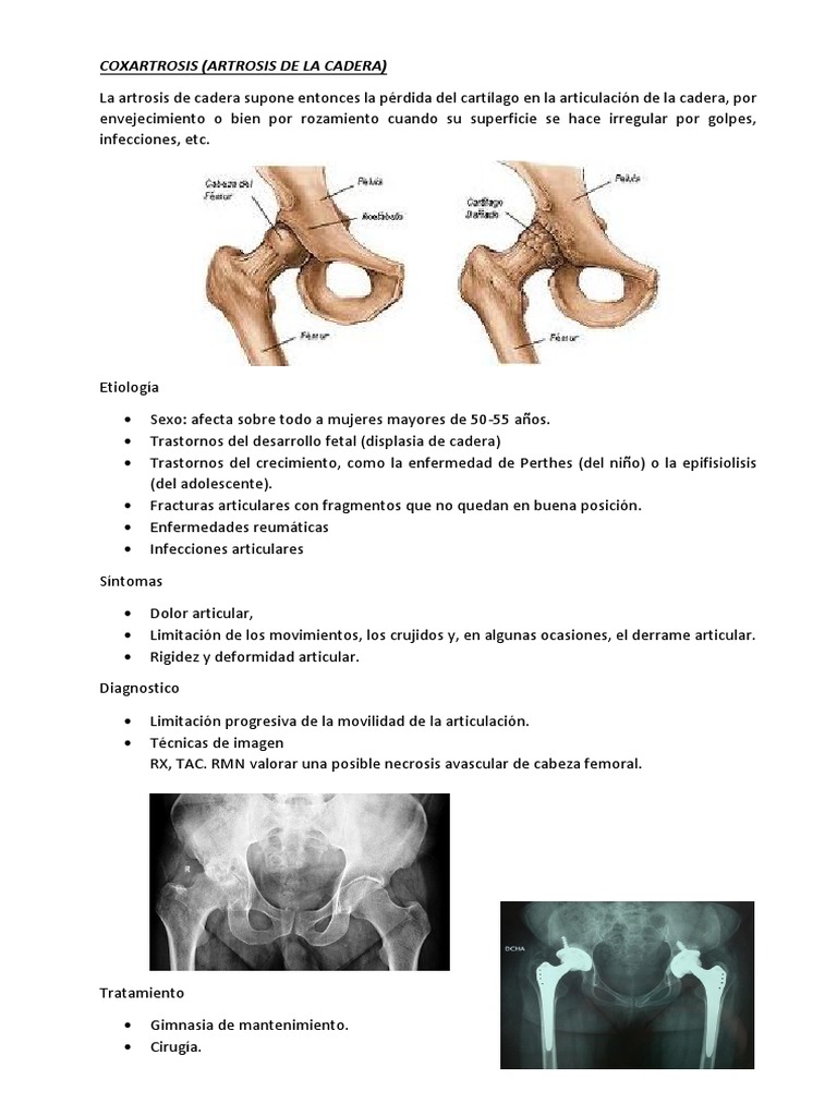 Enfermedades de la Cadera y Tratamientos | PDF | Traumatologia | Rodilla