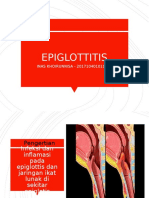 EPIGLOTITIS Inas