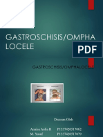 Gastroschisis Baru