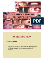 classification of mal occlusion new Dr.  vivek.pdf