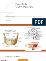 Fraktur Mandibula - PPT - Pangala & Ruth