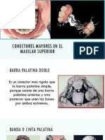 Diapositiva Conectores Mayores en El Maxilar Superior