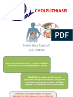 CHOLELITHIASIS