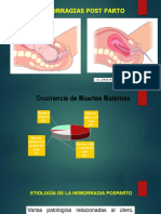 Hemorragis Post Parto