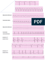 Ritmos Ekg