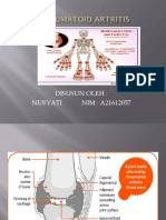 Artritis Reumatoid