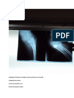 Radiografie Standard Cu Incidenta Antero-Posterioara Si de Profil Radiografie de Olecran Sau de Cot Mai Poti Sa Zici Fractura de Humerus Distal