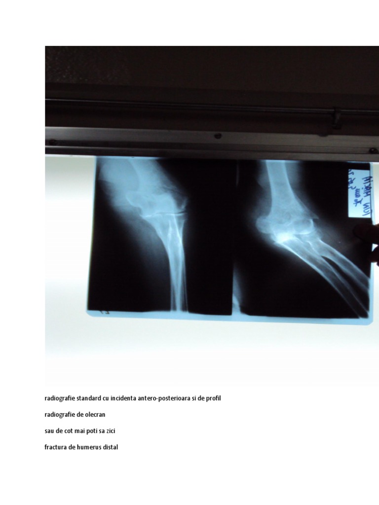 Radiografie Standard Cu Incidenta Antero-Posterioara Si de Profil ...