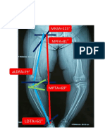 Abp 01 Rodilla