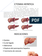 Lobectomia Hepatica