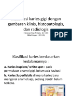 Klasifikasi Karies Gigi Dengan Gambaran Klinis, Histopatologis