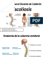 E Scoliosis