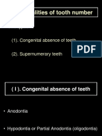 Tooth Abnormalities Including Missing and Extra Teeth