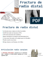 Fractura de Radio Distal