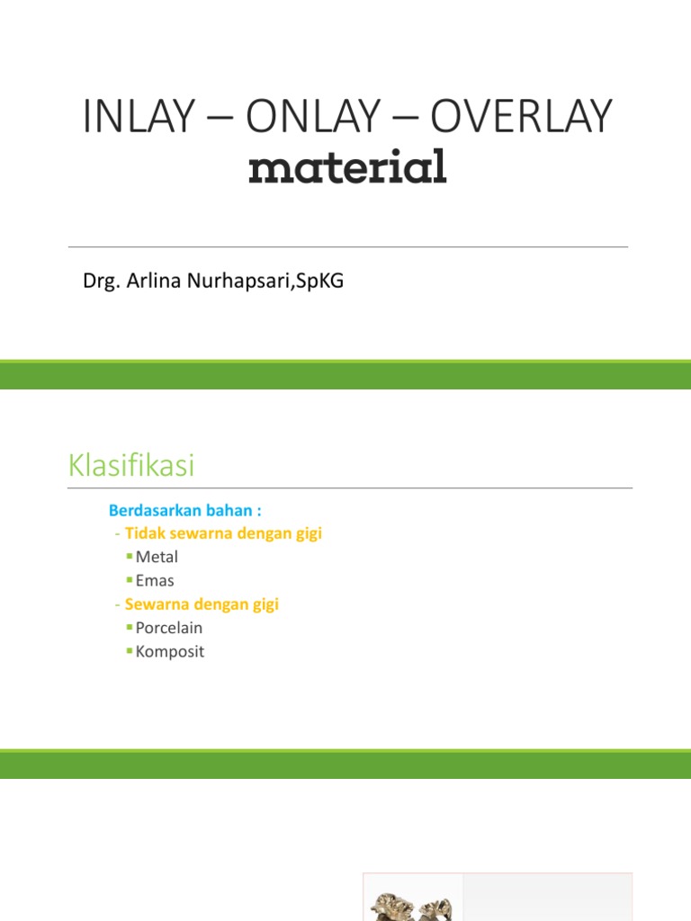 Inlay Onlay | PDF | Teknologi & Rekayasa | Griya & Taman