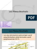 Plexus Brachialis