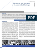 Management of Dilacerated and S-Shaped