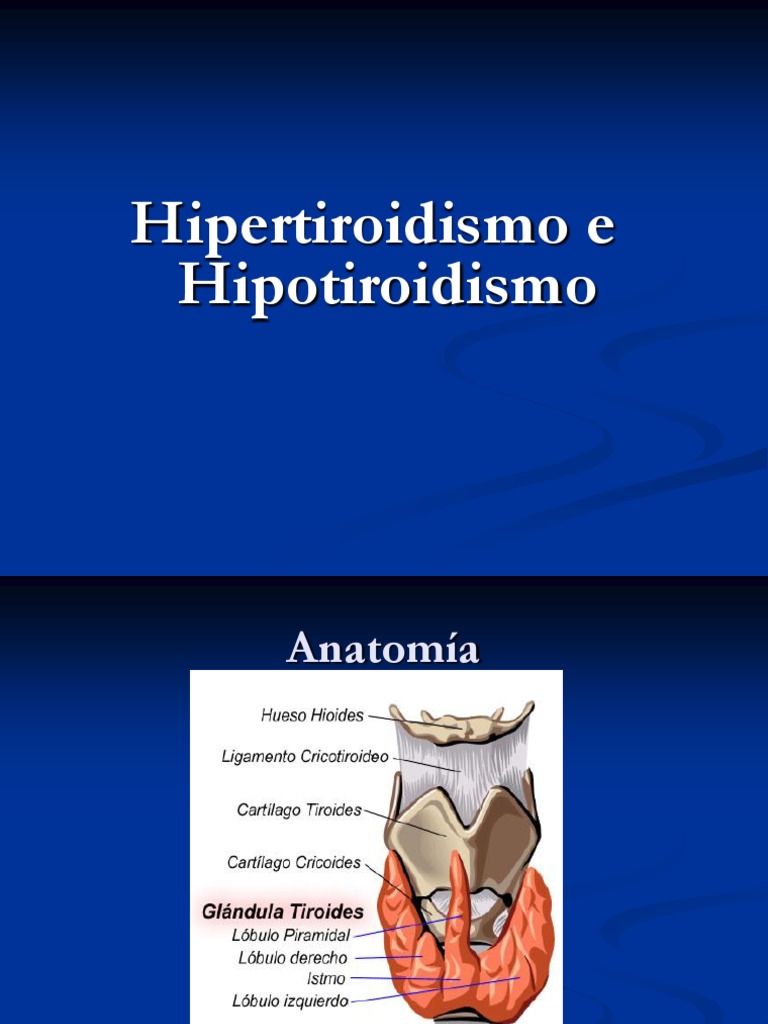 4 Hiper e Hipotiroidismo Hipertiroidismo Tiroides