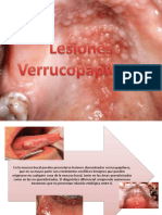 Lesiones Verrucopapilares