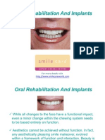 Oral Rehabilitation and Implants