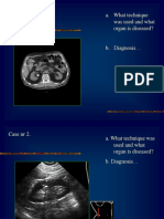 Case NR 1. A. What Technique Was Used and What Organ Is Diseased?