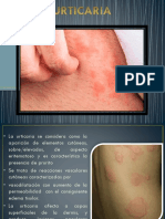 Urticaria