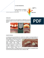 Traumatismos Sobre El Tejido Periodontal