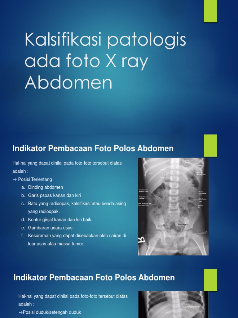 Kalsifikasi Patologis Ada Foto X Ray Abdomen