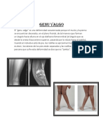 Genu-valgo.docx