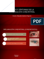 Signos y Síntomas de La Inflamación Conjuntival