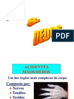 acidentes-maos-dedos