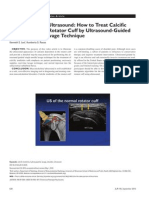 Musculoskeletal Ultrasound How To Treat Calcific