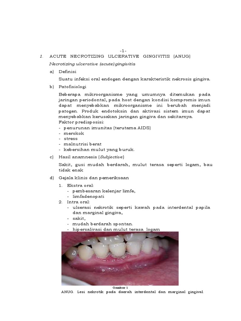 Pengertian dan Terapi ANUG | PDF