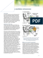 Acoustic Neuroma