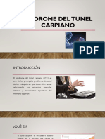 Sindrome Del Tunel Carpiano