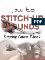 How.to.Stitch Up.wounds