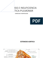 Estenosis e insuficiencia aórtica y pulmonar