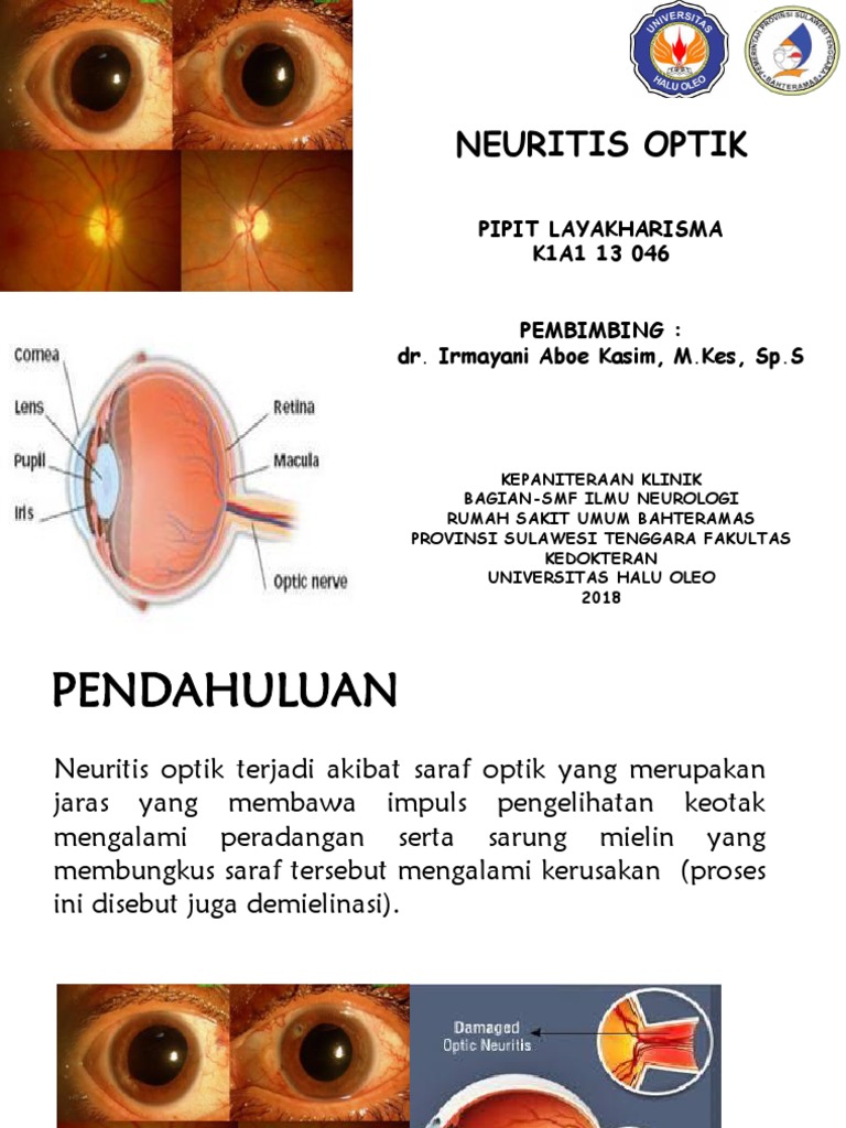 Neuritis | PDF | Sains & Matematika