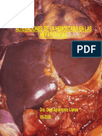 alteraciones__de_la_hemostasia_en_las_hepatopatiasii.pdf
