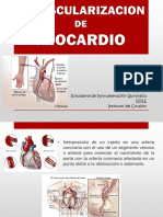 Revascularizacion de Miocardio