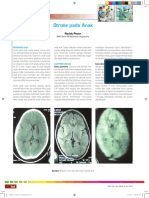 14_Stroke pada Anak.pdf