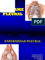 Derrame Pleural