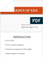 EKG Basics: An Introduction to ECG Interpretation