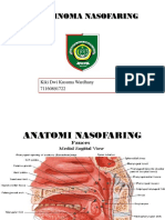 Karsinoma Nasofaring