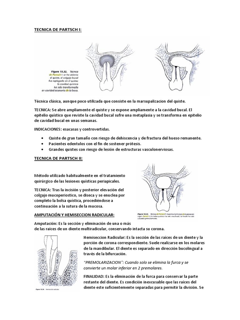 Técnica de Partsch en Cirugía Bucal | PDF | Medicina | Especialidades ...