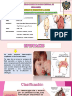 Diapositiva de Epistaxis